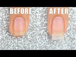 I Wanted To Show You All The Easiest And Quickest Way To Do A Refill Using The Gelish Structure Without The Ac Diy Acrylic Nails Acrylic Dip Nails Powder Nails
