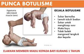 Salah satu kandungan obat batuk jenis mukolitik yang sering digunakan adalah bromhexine. Ini Apa Ibu Bapa Perlu Tahu Tentang Penyakit Botulisme