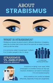 Strabismus Natural Ways To Help Resolve Crossed Eyes Dr Axe