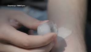 Aftermath salt and ice challenge. 5 Most Dangerous Social Media Challenges To Warn Your Kids About