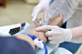 Image result for Venous Blood Sampling
