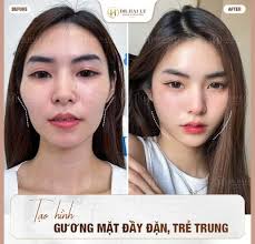 TIÊM TAI TÀI LỘC