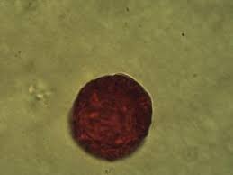 Image result for Buchnerodendron