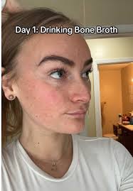 Bone Broth and Skin
