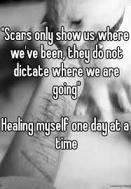 Scars Only Show Us Where We Ve Been They Do Not Dictate Where We Are Going Healing Myself One Day At A Time