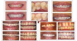 We pride ourselves on providing first class service to our patients; Private Dental Clinic Near Me General Cosmetic Dentistry