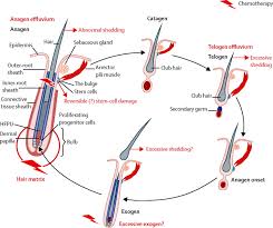 Hair loss will typically begin 1 to 2 weeks after the first chemotherapy treatment and become most obvious after a. References In Pathobiology Of Chemotherapy Induced Hair Loss The Lancet Oncology