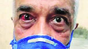 భయంతో లోపలికి పరుగెత్తుతున్న మదన్‌ను చొక్కా పట్టుకొని లాగి విచక్షణ రహితంగా దాడికి పాల్పడ్డారు. Sena Shakha Pramukh Attacks Retired Navy Officer For Forwarding Cartoon On Uddhav Thackeray Arrested Cities News The Indian Express