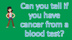 A cancer may also cause symptoms like fever, extreme tiredness (fatigue), or weight loss. Can You Tell If You Have Cancer From A Blood Test Best Health Answers Youtube