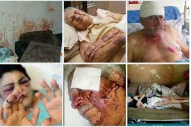 Résultat de recherche d'images pour "south africa white farmer murders"