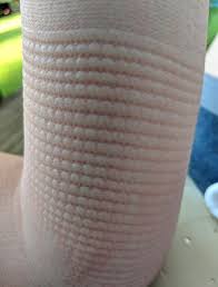 Maybe you would like to learn more about one of these? Dead Skin Arm After Cast Removal Facial Scrub