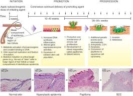 Second, this expansion includes rules on how to incorporate the new components and options from the a storm of swords game into the original a game of thrones. Multi Stage Chemical Carcinogenesis In Mouse Skin Fundamentals And Applications Nature Protocols