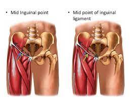 Medieval latin ~um, from latin, band, tie, from ligare date: Inguinal Ligament Ppt Download