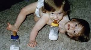 Abby and brittany hensel are two of the boldest and bravest human beings we know. Conjoined Twins Abby And Brittany Hensel From Minnesota Set To Become Reality Tv Stars Mirror Online