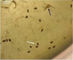 Pesticides are chemicals used to control pests, including biological control reduces the population of the pest but does not completely remove the pest. In Vitro Ovicidal Effect Of A Senecio Brasiliensis Extract And Its Fractions On Haemonchus Contortus Bmc Veterinary Research Full Text