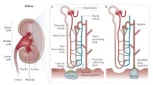 Kidney Stones The Integrative Approach To Prevention And Management