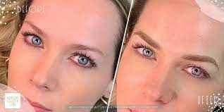 Meantime you feel the pigment is fading. Dallas Microblading Gallery Voted The Best Brow Studio In Dallas 214 945 0099