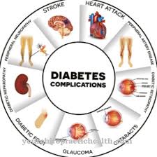 Penyakit diabetes merupakan sebuah penyakit yang diakibatkan karena tubuh tidak atau hanya sedikit bisa memproduksi insulin. Neuropati Diabetes Punca Gejala Rawatan Penyakit
