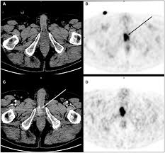 Image result for CT Intravenous Contrast