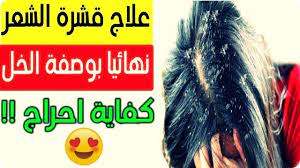 طريقة التخلص من قشرة الشعر بالخل playbill