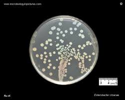 Image result for Enterobacter