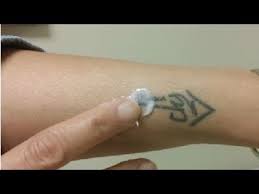It is cheap way to remove tattoo ink on ski. Guide How To Remove Tattoo Ink From Skin At Home Remove Tattoo Ink On Skin Naturally Youtube