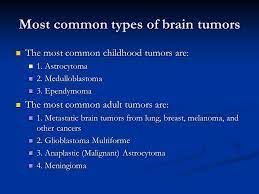 A malignant tumor is a cancerous growth that spreads and infiltrates into other brain tissue. Brain Tumors Maria Rountree Most Common Types Of Brain Tumors The Most Common Childhood Tumors Are The Most Common Childhood Tumors Are 1 Astrocytoma Ppt Download
