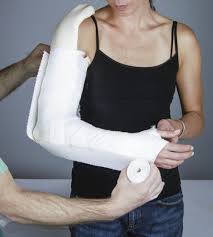 Image result for Long Arm Splint