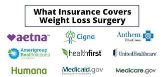 However, seiu has regional plans that may have policies that vary. How To Get Weight Loss Surgery Approved Jet Medical Tourism In Mexico