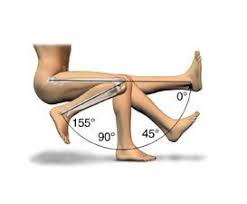 Generally Most Knee Implants Allow You To Bend Your Knee Upto 120 135 Degr Knee Replacement Recovery Knee Replacement Surgery Recovery Knee Replacement Surgery