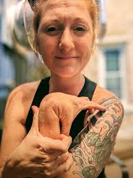 My now 18 yr old daughter has been battling dyautonomia for a few years  now. She recently started having mcas symptoms and starting to have GI  issues. I feel like we treat