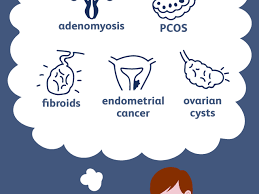The ovaries are a pair of small organs in the female reproductive system that contain and release an. Signs And Symptoms Of An Enlarged Uterus
