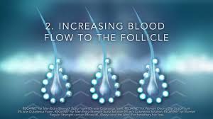 The common inherited thinning or hair loss process begins slowly and may become noticeable only after years of gradual loss. How Minoxidil Works For Hair Loss Regaine Hair Loss Treatments Youtube