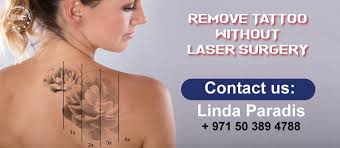 Tattoo removal isn't as easy as getting a tattoo—but it definitely hurts as much. Blog