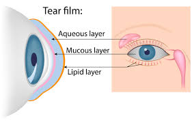 Dry Eye Cornea Roswell Eye Clinic