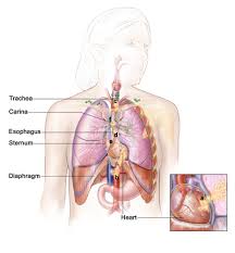 The cough is often described as hacking or raspy, and may cause phlegm or mucus to come up. Non Small Cell Lung Cancer Diagnosed Florida Cardiopulmonary Center