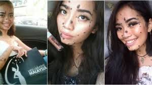 We did not find results for: Grain De Beaute Faut Il Le Faire Enlever Un Grain De Beaute Qui Gene Femme Actuelle Le Mag