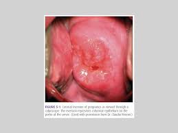Just started taking vitiams, having a little stomache ache tonight. Physiological Changes In Pregnancy Ppt Video Online Download