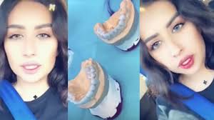 ردة فعل فرح الهادي بعدما ما سوت تجميل للأسنان وركبت أسنانها الجديدة لوك الارنب Youtube