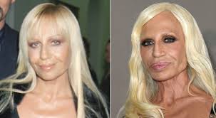 You asked us, so here is our article about celebrity plastic surgery disasters gone wrong with before after photos. Sroub Nakup Provoz Donatella Versace Before Plastic Lev Potrebuji Piknik