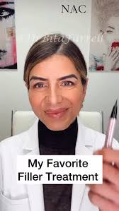 One of my absolute favorite treatments for women, men, and myself is cheek  restoration., The deep medial cheek is one of the first areas where we lose  volume as we age. This subtle hollowing flattens ...