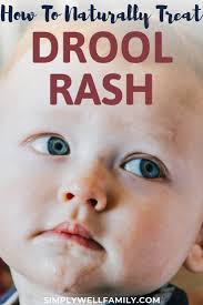 How To Manage Baby Drool Remedies Simply Well Family Drooling Baby Baby Neck Rash Baby Rash On Face