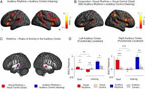 A) the brain reaches its maximum weight around the seventh decade of life. Task Specific Reorganization Of The Auditory Cortex In Deaf Humans Pnas