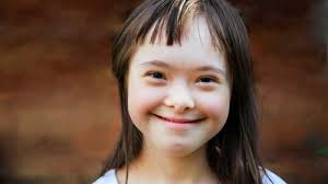 Welche Folgen Haben Down Syndrom Bluttests Kirche Leben