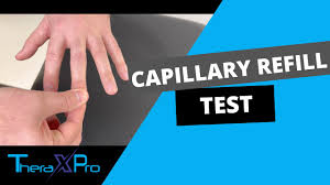 Image result for Capillary Refill