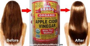 You Should Try Washing Your Hair With Acv Here S Why Apple Cider Vinegar For Hair Vinegar For Hair Apple Cider Vinegar Hair Rinse