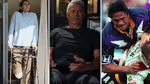 ‘I’m taking it home’: Wild true tale about Storm legend’s amputated leg... and BBQ prank he pulled