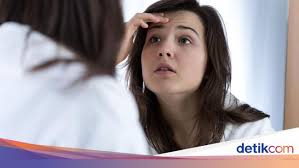 Kenapa tumbuh jerawat di dahi? 7 Penyebab Jerawat Di Dahi Dan Cara Menghilangkannya