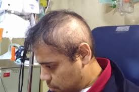 Fundraiser for Diana Pamela Serquen Guerra by Raul Faya : Help Raul Beat  Acute Myeloid Leukemia Cancer