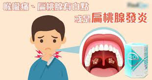 喉嚨痛 說不出聲 食不下嚥 可能並非傷風感冒 而是扁桃腺發炎引致 扁桃腺發炎和喉嚨發炎的部分病徵很相似 故不少人難以區分而延誤治療 我們可如何分辨 扁桃腺發炎和喉嚨發炎呢 如患扁桃腺炎 應怎樣治療和日常護理 恰逢煙霾蔓 family guy character